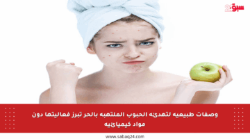 وصفات طبيعية لتهدئة الحبوب الملتهبة بالحر تبرز فعاليتها دون مواد كيميائية